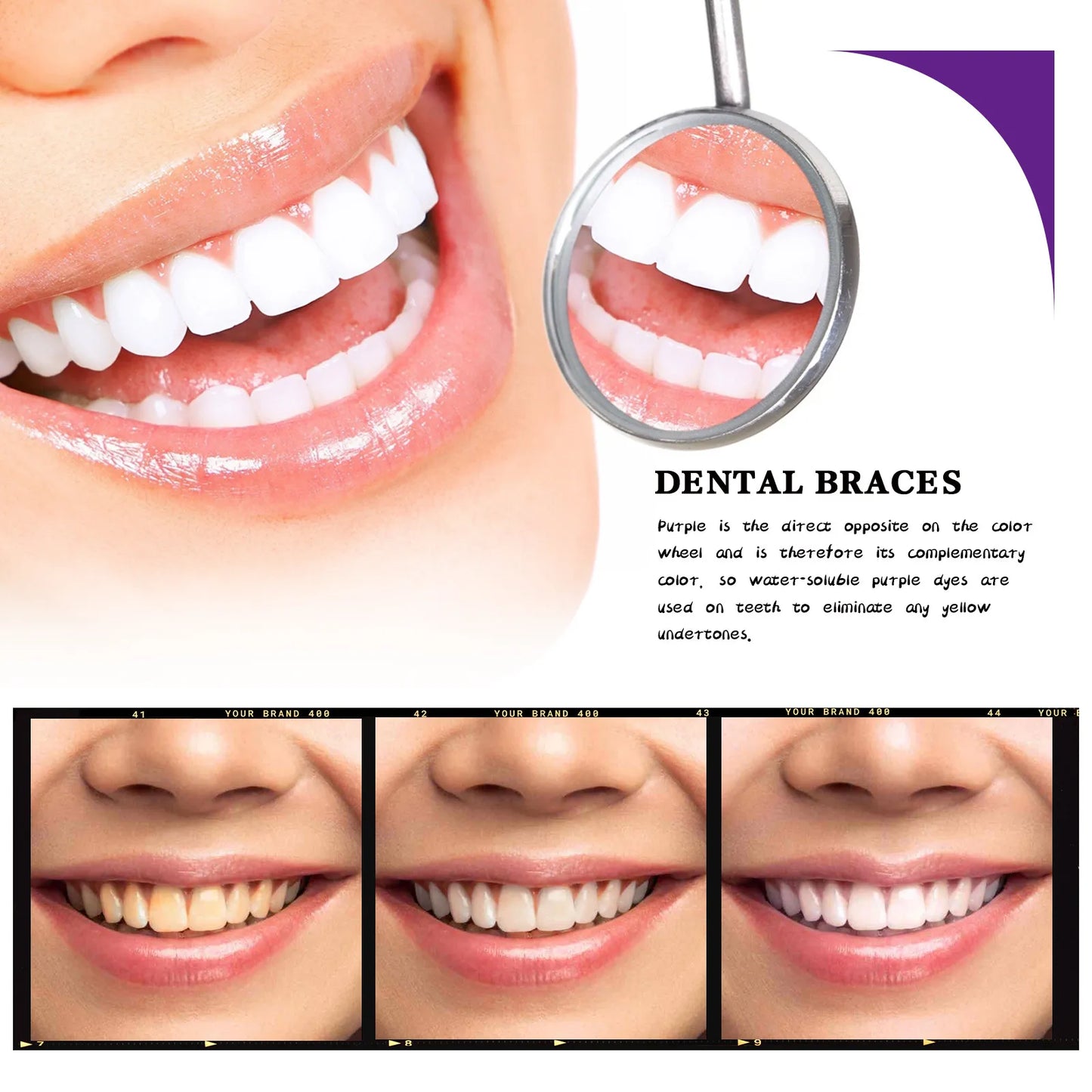 V34 Tooth Cleaning Mousse – Whitening & Gum Care