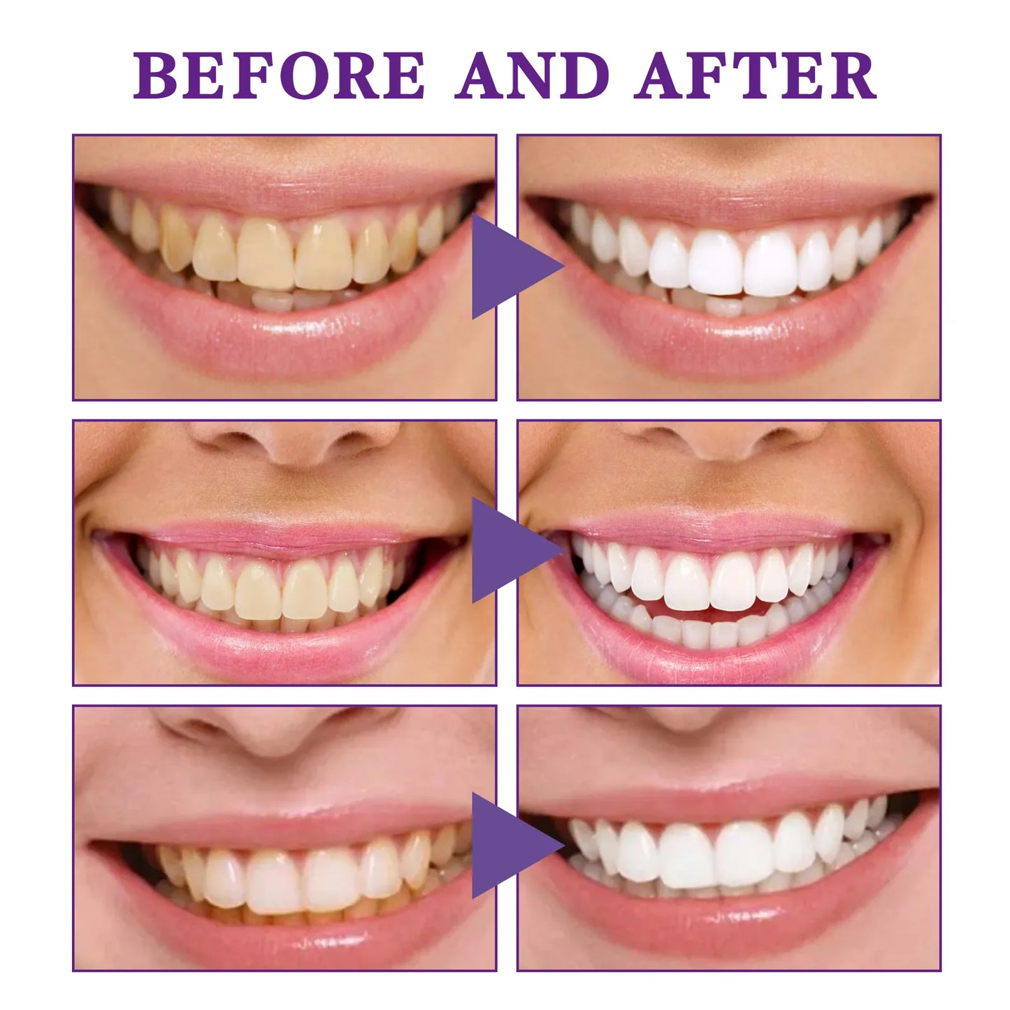 V34 Tooth Cleaning Mousse – Whitening & Gum Care