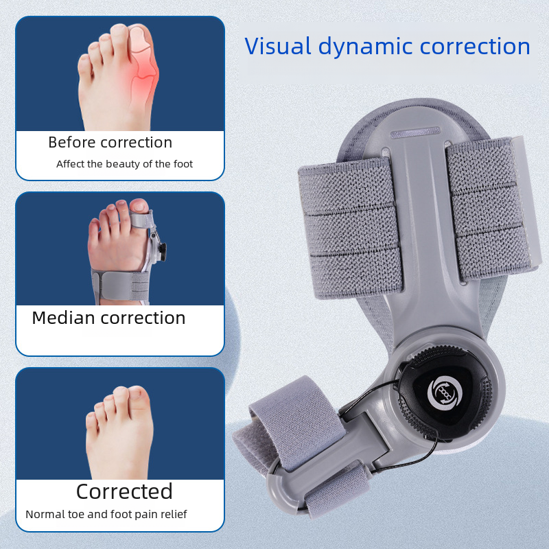 Adjustable Bunion Corrector – Toe Alignment Splint