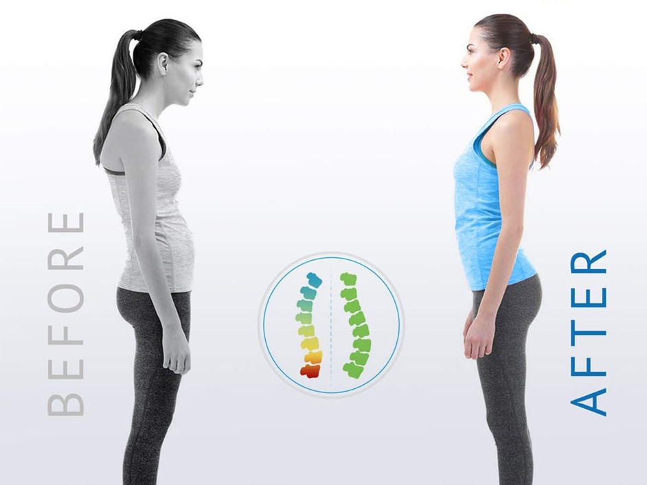 Posture Corrector – Adjustable Back & Shoulder Support
